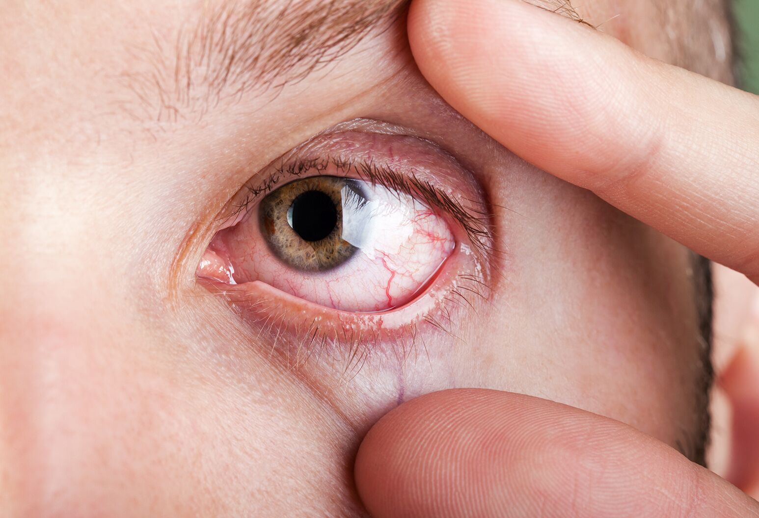 Common Eye Conditions Explained: Symptoms, Causes, and Treatment Options!
