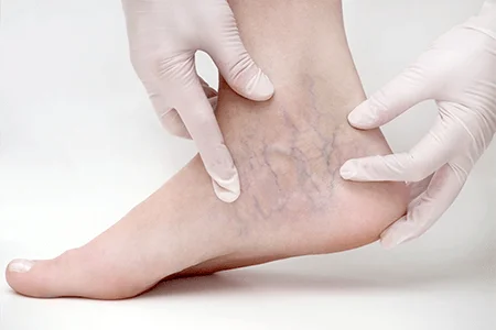 Podiatry plays a role in wound care, particularly for the lower extremities