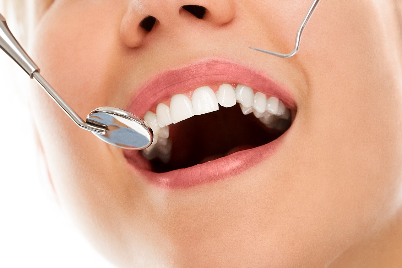 Exploring the Benefits of Dental Crowns for Tooth Restoration