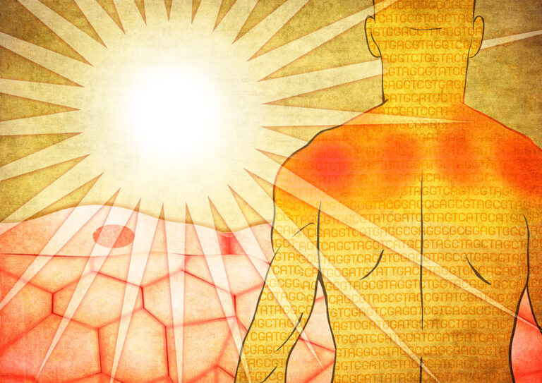 Exploring the Link Between Sun Exposure and Skin Cancer