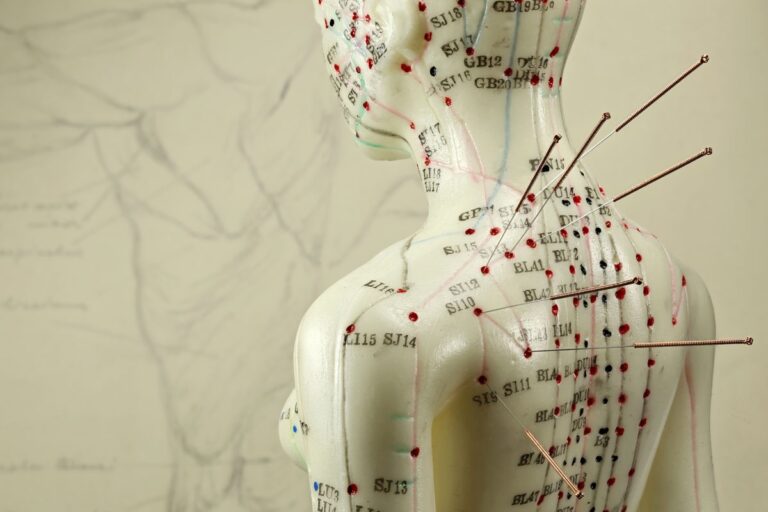 How Acupuncture for Insomnia Works