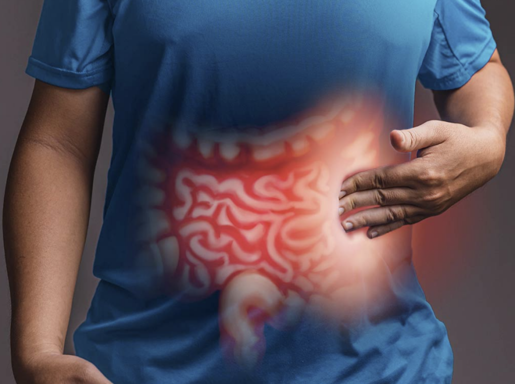 How Exercise Affects Inflammatory Bowel Disease