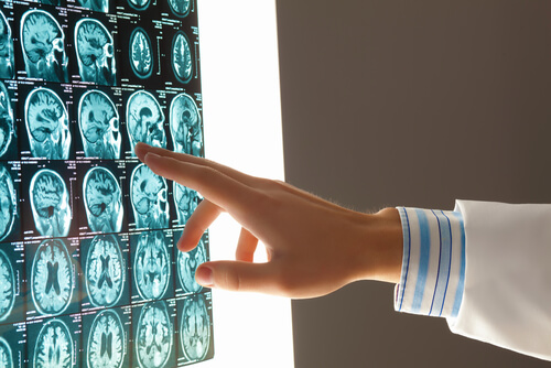 How Neuroradiology Plays a Key Role in Brain Trauma Evaluation