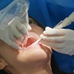 How Oral Surgery Helps Restore Function to Your Teeth and Jaw