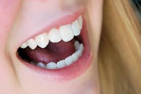 How To Safely Whiten Your Teeth Without Causing Damage