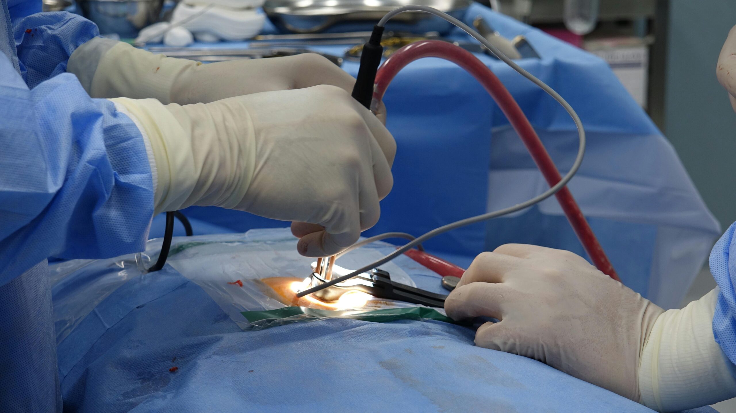 How to Choose the Right Surgeon for Gallbladder Surgery