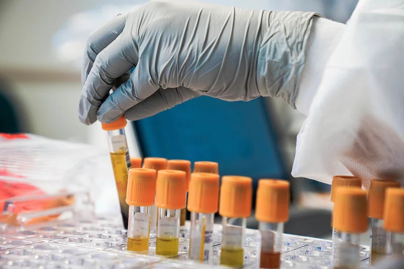 Lab Services That Primary Care Doctors Offer