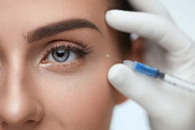 Questions To Ask Your Botox Provider