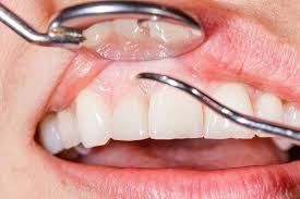 The Connection Between Dental Exams and Overall Health