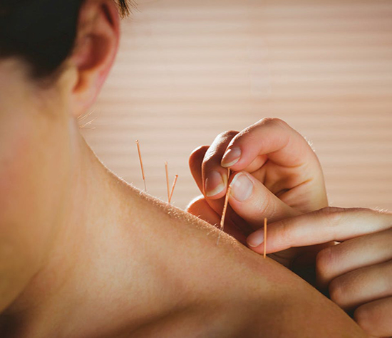 The Science Behind Acupuncture and Its Benefits