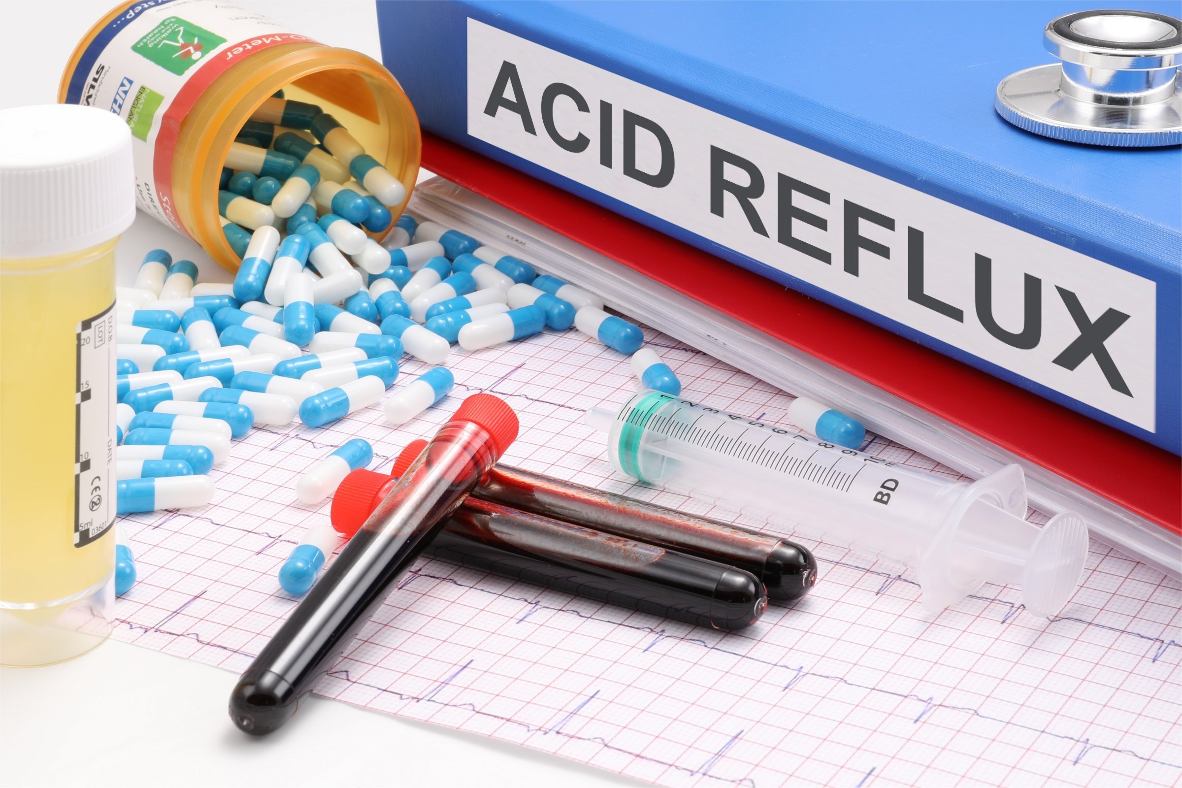 Understanding Acid Reflux and Its Treatments
