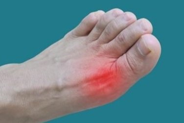 Understanding Tendinitis: Symptoms Beyond Just Pain