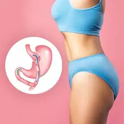 Understanding the Types of Anti-reflux Surgery for Acid Reflux