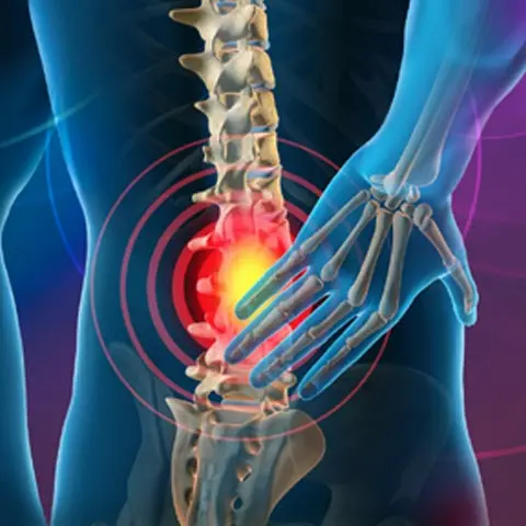 What Happens During Disc Surgery for Chronic Disc Pain
