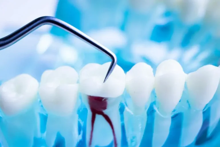 Why Restorative Dentistry Is Essential for Maintaining Your Oral Health