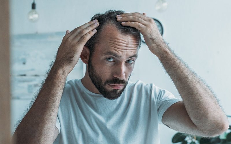 4 Strategies for Hair Restoration