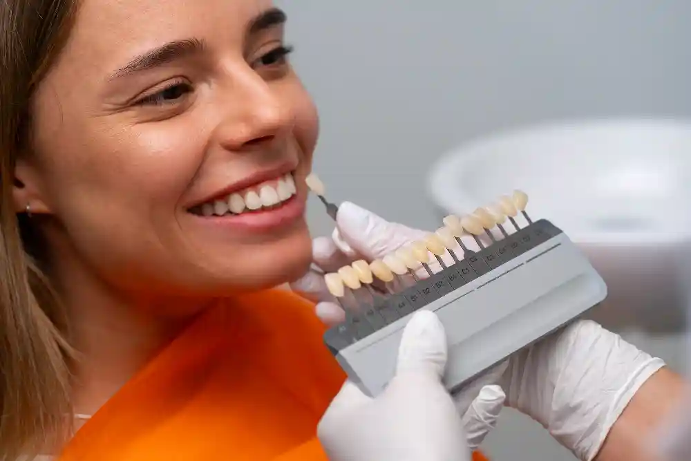 Benefits of Choosing Veneers