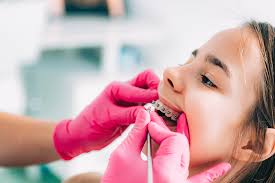 Common Causes of Cavities in Children