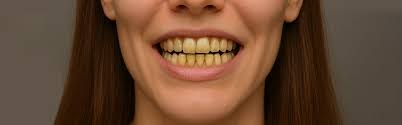 Common Dental Emergencies and How To Handle Them