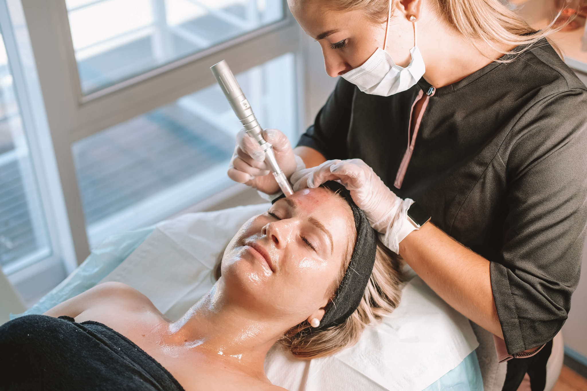 How Microneedling Improves Skin Texture and Tone