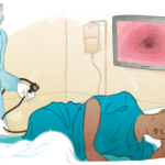 Navigating Life After Colon Cancer Surgery