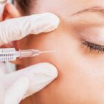 Preparation and Recovery Tips for Cataract Surgery