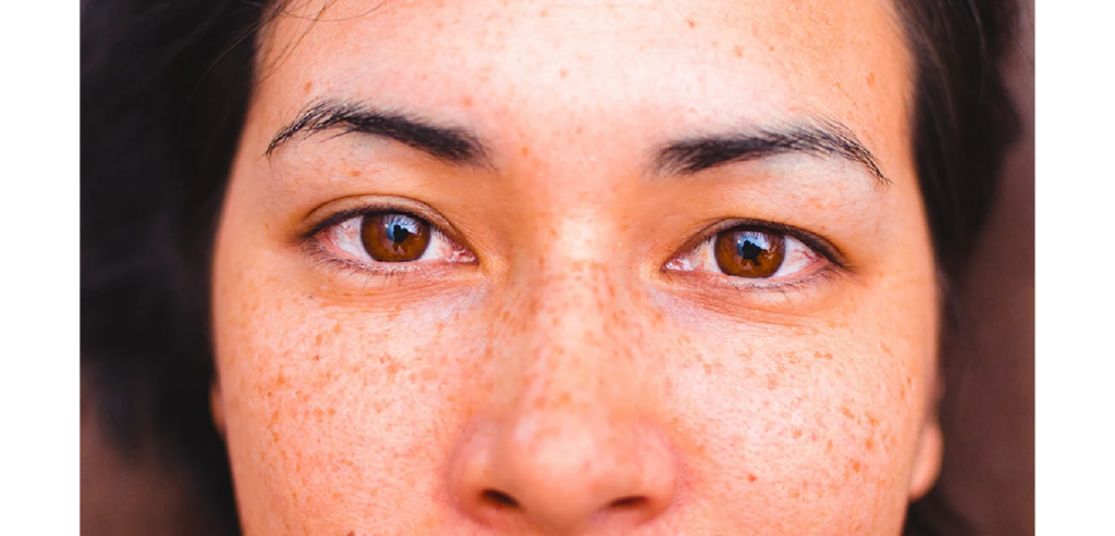 The Impact of Climate Change on Your Skin