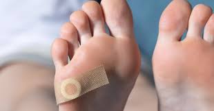 The Most Effective Treatments for Plantar Warts: A Comprehensive Guide