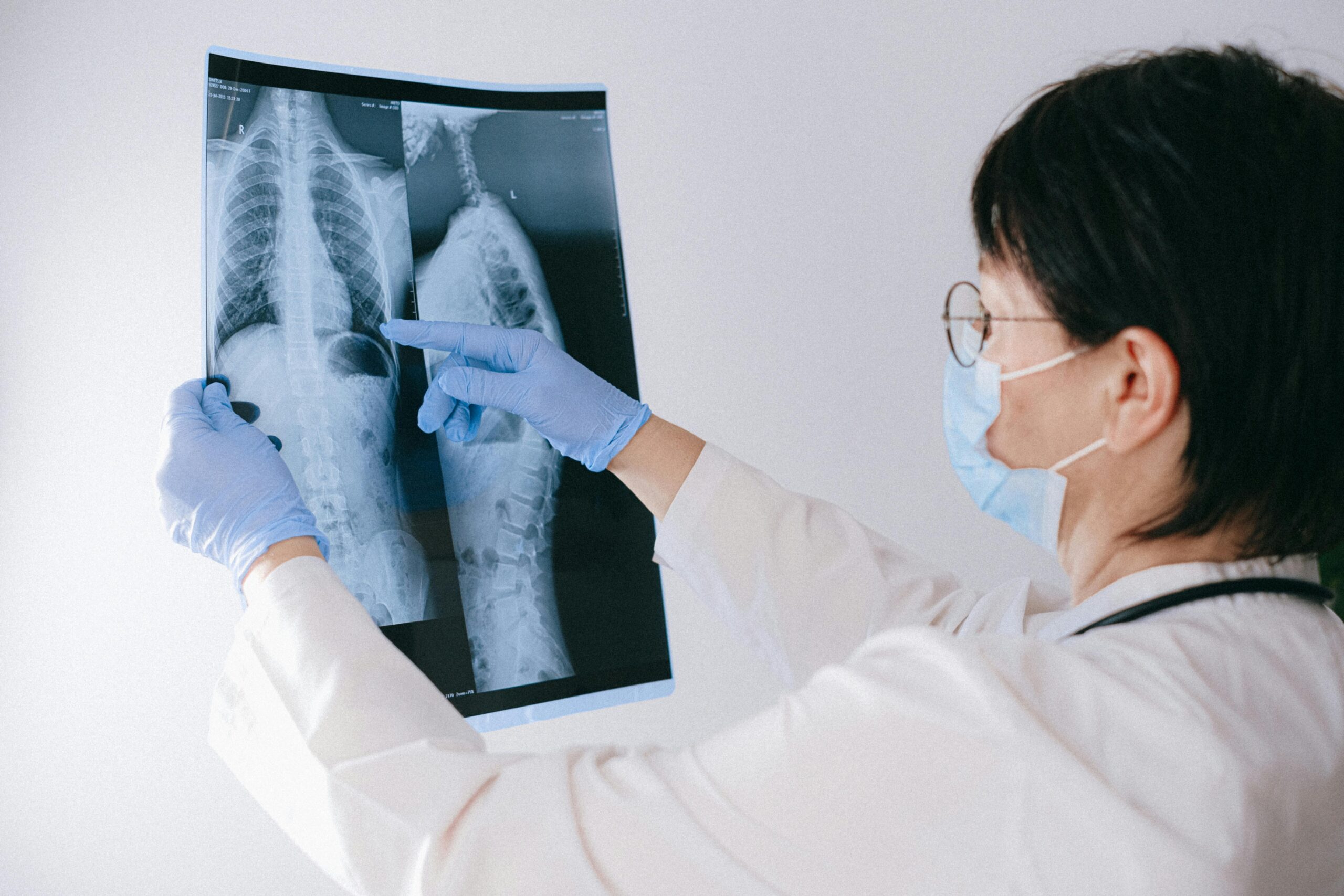 What Conditions Do X-Rays Help Diagnose?