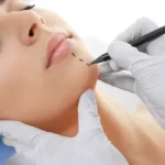 Choosing the Right Plastic Surgeon for Your Cosmetic Procedure