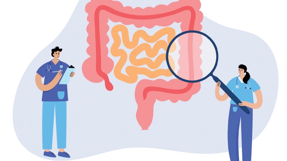 Screening and Prevention Strategies for Colon Cancer