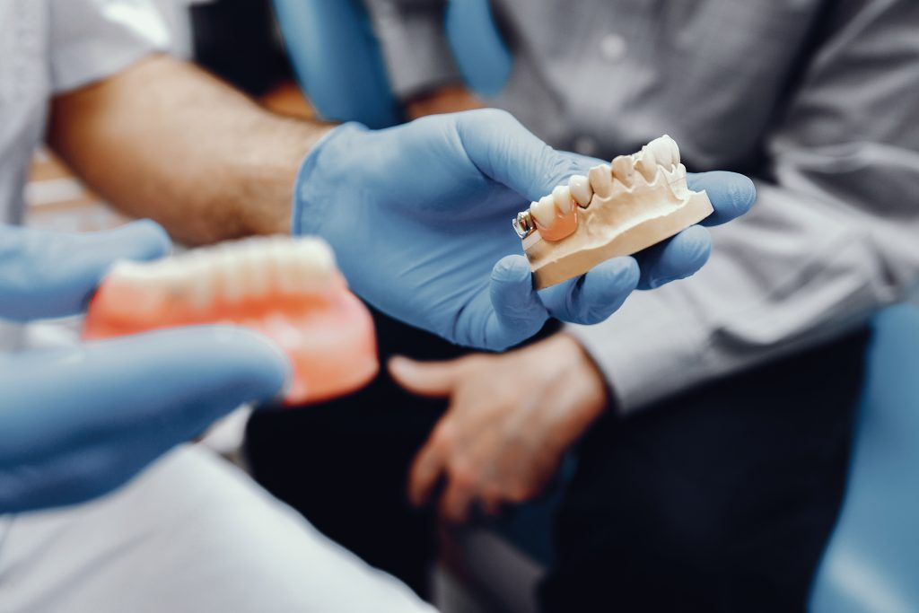 Understanding the Benefits of Dental Bridges