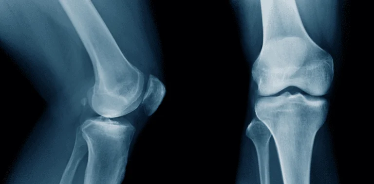 When to see an orthopedic surgeon