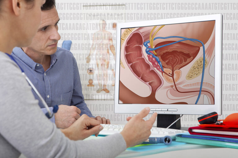 Defining an Enlarged Prostate and How To Treat It